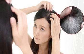 Tiết lộ phương pháp tự nhiên ngăn tóc bạc hiệu quả