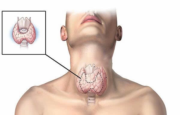 Những bệnh ung thư nào nếu phát hiện sớm có khả năng chữa khỏi cao?